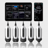 Chison SonoEye Chison SonoEye